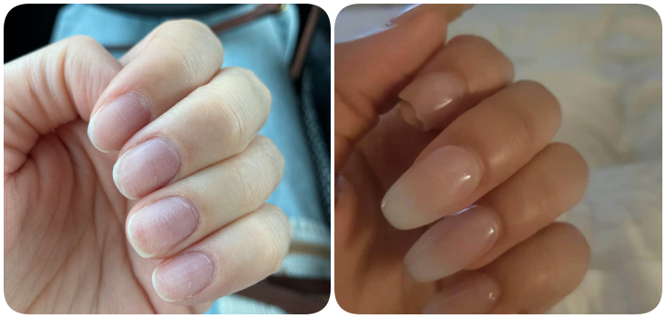 LuxeNail Pro before and after